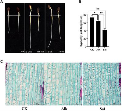 Insight Between the Epigenetics and Transcription Responding of Cotton Hypocotyl Cellular Elongation Under Salt-Alkaline Stress